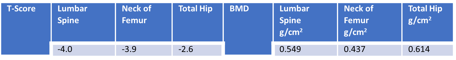 1st DXA Scan (Before Romosozumab treatment)