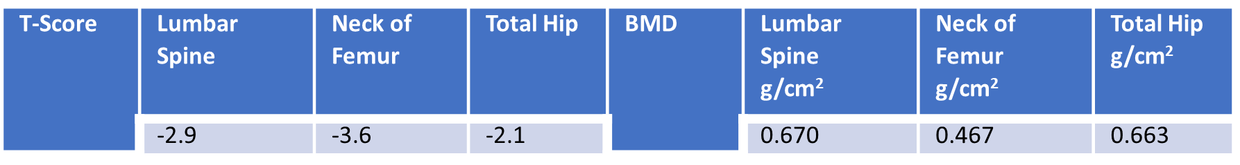 2nd DXA Scan (1 year after romosozumab treatment)