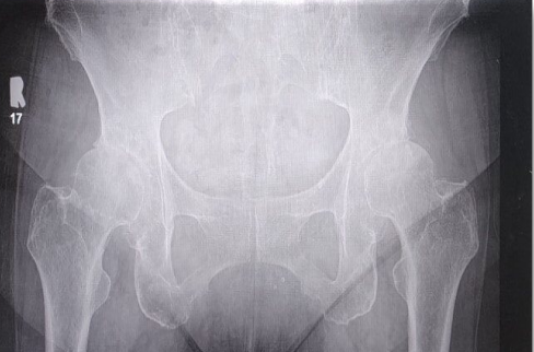 Case 1-thumbnail