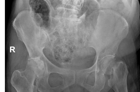 Case 2-thumbnail