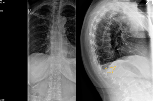 Case 3-thumbnail