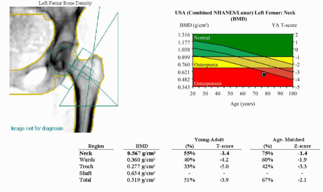 Baseline DXA Scan Results1